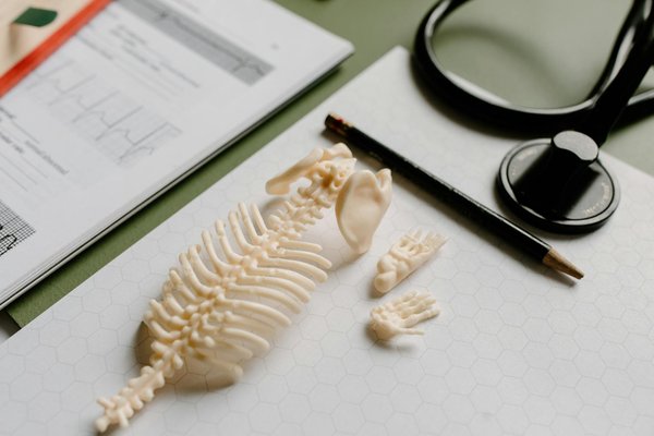 Quel style de yoga choisir pour mincir?